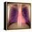 Lungs And Heart, X-ray-Du Cane Medical-Framed Premier Image Canvas