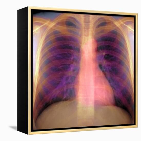 Lungs And Heart, X-ray-Du Cane Medical-Framed Premier Image Canvas