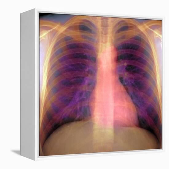 Lungs And Heart, X-ray-Du Cane Medical-Framed Premier Image Canvas