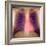 Lungs And Heart, X-ray-Du Cane Medical-Framed Premium Photographic Print