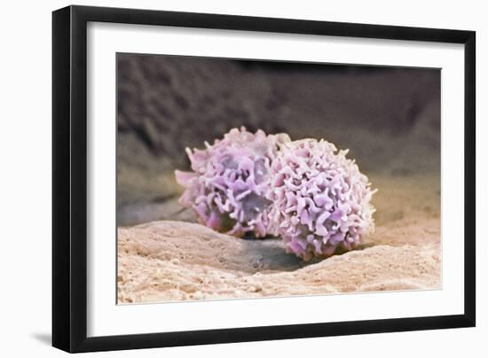 Macrophage Cells, SEM-Thomas Deerinck-Framed Photographic Print