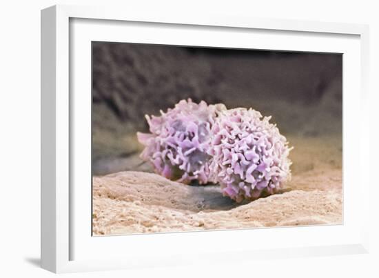 Macrophage Cells, SEM-Thomas Deerinck-Framed Photographic Print