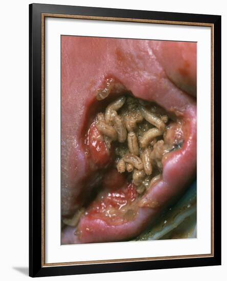 Maggots (Lucilia Sericata) Cleaning a Wound-Volker Steger-Framed Photographic Print