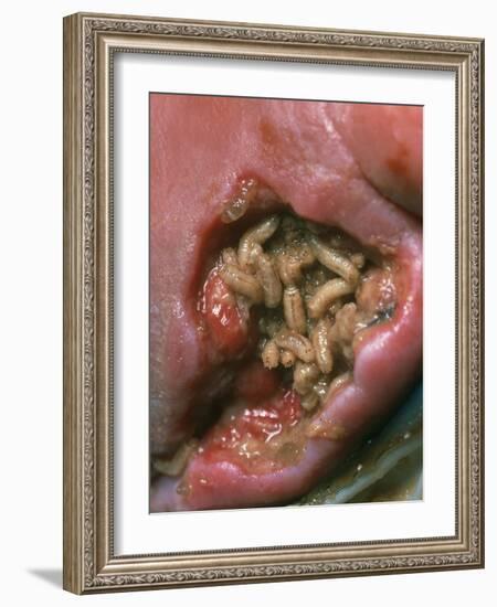 Maggots (Lucilia Sericata) Cleaning a Wound-Volker Steger-Framed Photographic Print