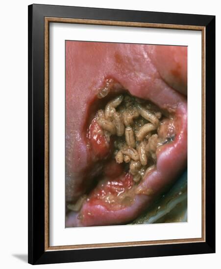 Maggots (Lucilia Sericata) Cleaning a Wound-Volker Steger-Framed Photographic Print