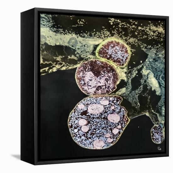 Malaria Parasites, TEM-null-Framed Premier Image Canvas