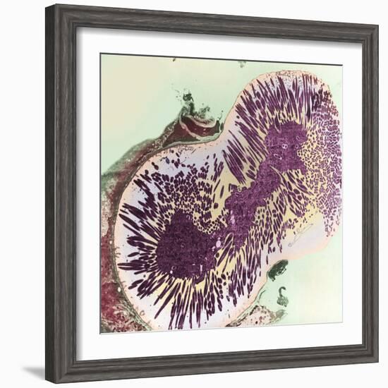 Malaria Parasites, TEM-null-Framed Premium Photographic Print