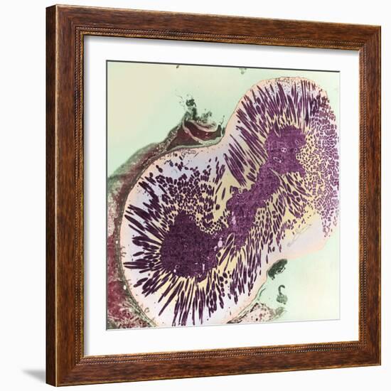 Malaria Parasites, TEM-null-Framed Premium Photographic Print