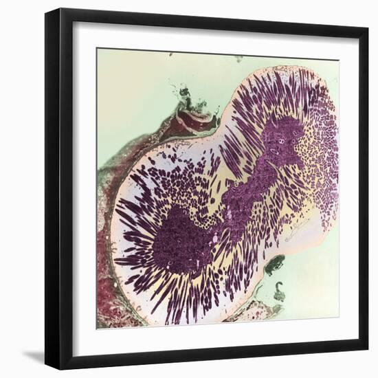 Malaria Parasites, TEM-null-Framed Premium Photographic Print