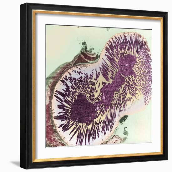 Malaria Parasites, TEM-null-Framed Premium Photographic Print