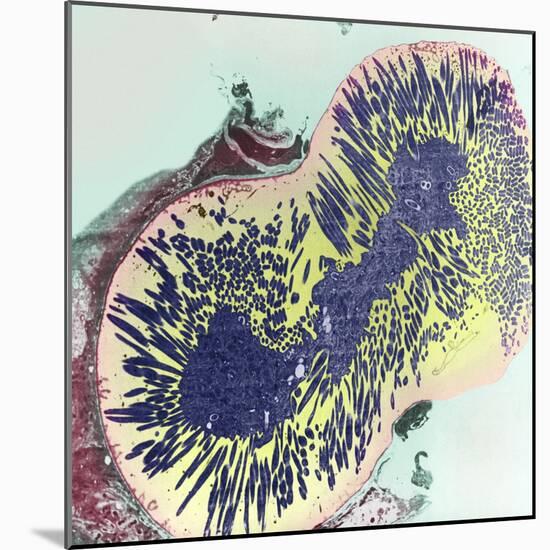 Malaria Parasites, TEM-null-Mounted Premium Photographic Print