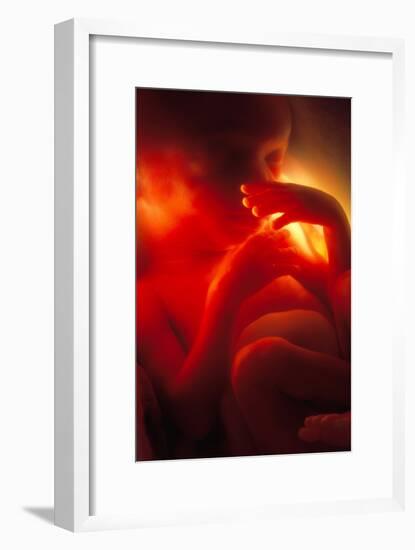 Male Foetus Aged 5 Months-Neil Bromhall-Framed Photographic Print