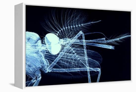 Male Mosquito Head, Light Micrograph-Steve Gschmeissner-Framed Premier Image Canvas