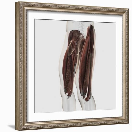 Male Muscle Anatomy of the Human Legs, Side View-null-Framed Art Print