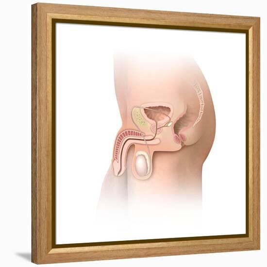 Male Pelvic Region, Artwork-Henning Dalhoff-Framed Premier Image Canvas