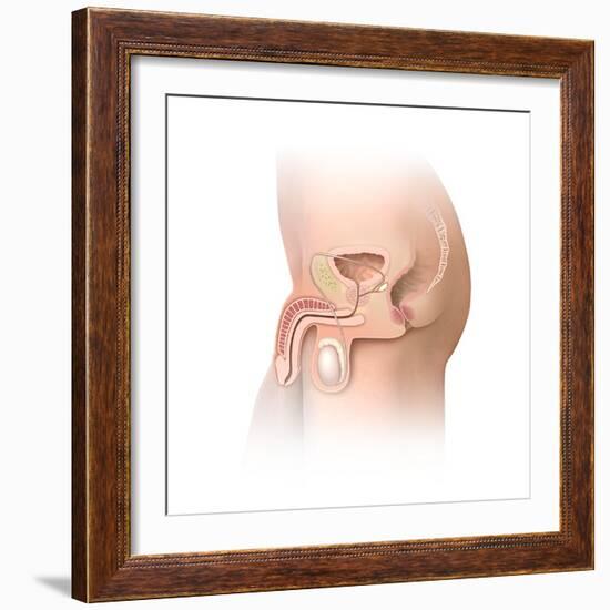 Male Pelvic Region, Artwork-Henning Dalhoff-Framed Premium Photographic Print