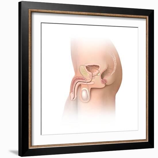 Male Pelvic Region, Artwork-Henning Dalhoff-Framed Premium Photographic Print