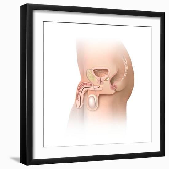 Male Pelvic Region, Artwork-Henning Dalhoff-Framed Premium Photographic Print