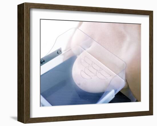 Mammography-Science Photo Library-Framed Photographic Print