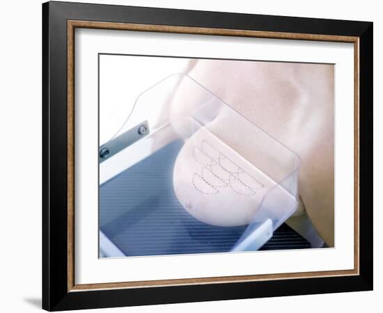 Mammography-Science Photo Library-Framed Photographic Print