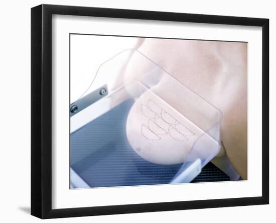 Mammography-Science Photo Library-Framed Photographic Print