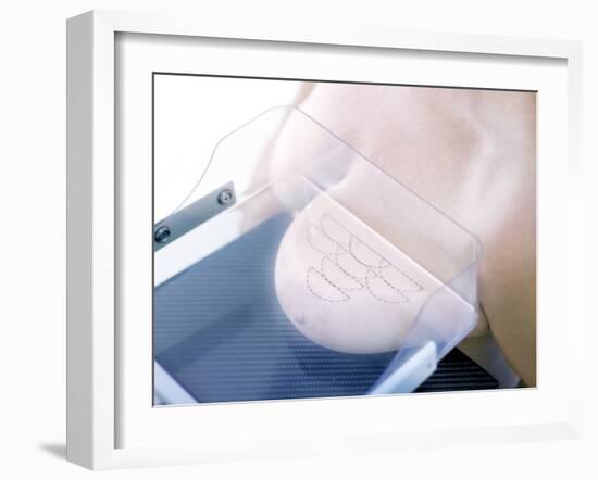 Mammography-Science Photo Library-Framed Photographic Print