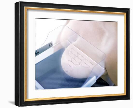 Mammography-Science Photo Library-Framed Photographic Print