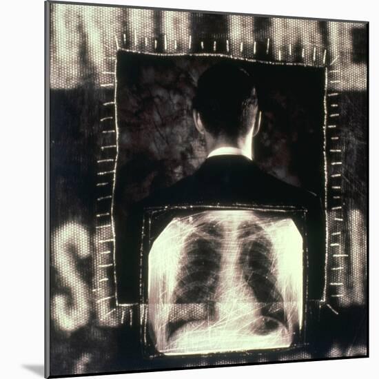 Man  And  X-ray-null-Mounted Photographic Print