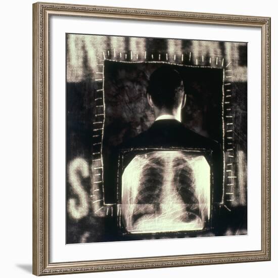 Man  And  X-ray-null-Framed Photographic Print