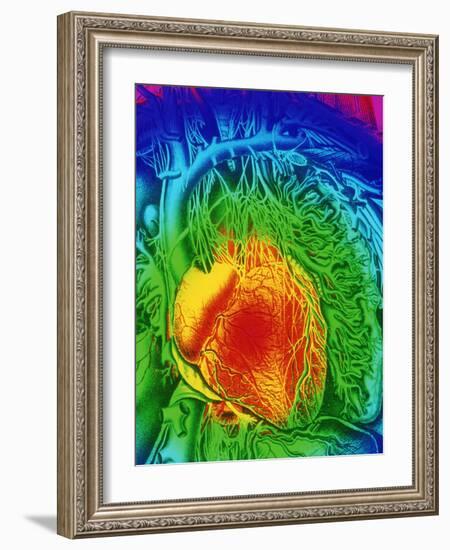 Mascagni Artwork of Human Heart with Its Nerves-Mehau Kulyk-Framed Photographic Print