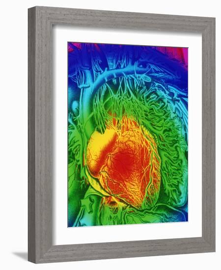 Mascagni Artwork of Human Heart with Its Nerves-Mehau Kulyk-Framed Photographic Print