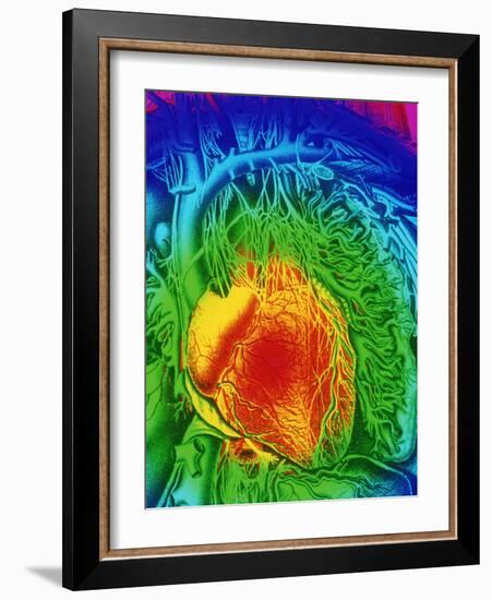 Mascagni Artwork of Human Heart with Its Nerves-Mehau Kulyk-Framed Photographic Print