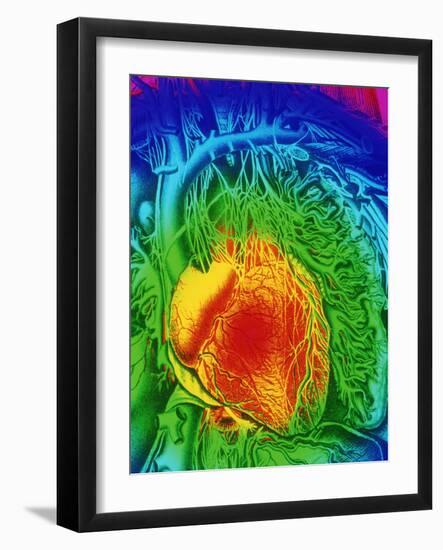 Mascagni Artwork of Human Heart with Its Nerves-Mehau Kulyk-Framed Photographic Print