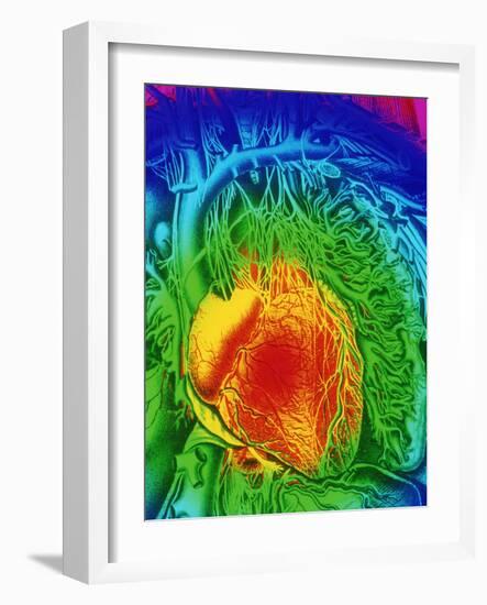 Mascagni Artwork of Human Heart with Its Nerves-Mehau Kulyk-Framed Photographic Print