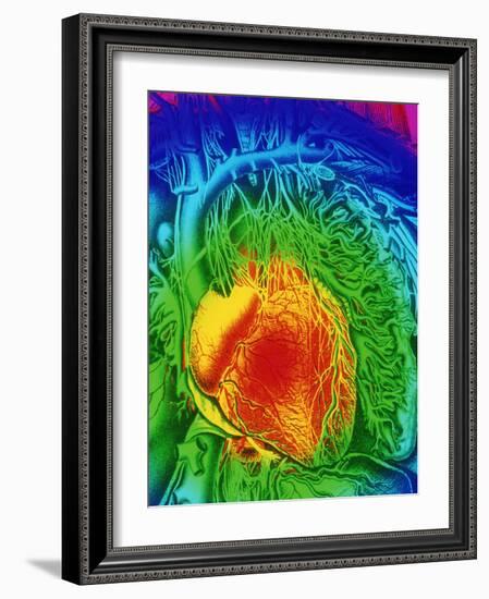 Mascagni Artwork of Human Heart with Its Nerves-Mehau Kulyk-Framed Photographic Print