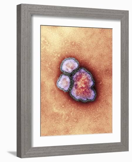 Measles Virus Particles, TEM-Hazel Appleton-Framed Photographic Print