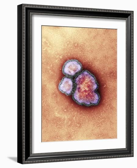 Measles Virus Particles, TEM-Hazel Appleton-Framed Photographic Print