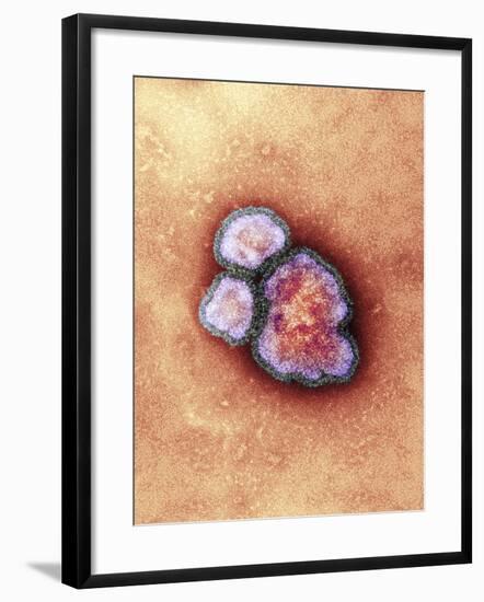 Measles Virus Particles, TEM-Hazel Appleton-Framed Photographic Print