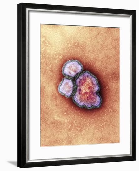 Measles Virus Particles, TEM-Hazel Appleton-Framed Photographic Print