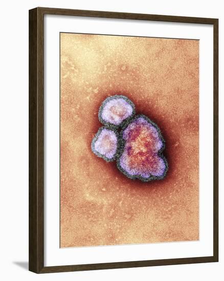 Measles Virus Particles, TEM-Hazel Appleton-Framed Photographic Print