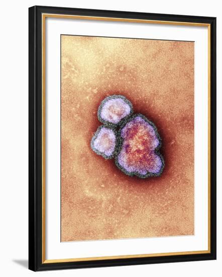 Measles Virus Particles, TEM-Hazel Appleton-Framed Photographic Print