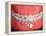 Medical Illustration of Human Mouth Showing Teeth, Gums and Metal Braces-null-Framed Stretched Canvas