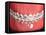 Medical Illustration of Human Mouth Showing Teeth, Gums and Metal Braces-null-Framed Stretched Canvas