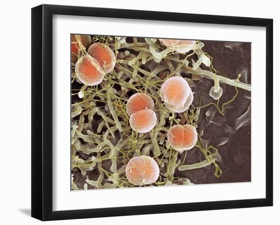 Meningitis Bacteria, SEM-Science Photo Library-Framed Photographic Print