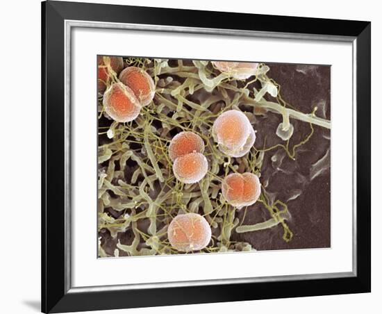 Meningitis Bacteria, SEM-Science Photo Library-Framed Photographic Print