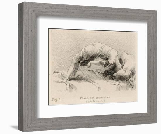 Mental Patient at la Salpetriere Going Through the Phase of Contortions-P. Richer-Framed Photographic Print