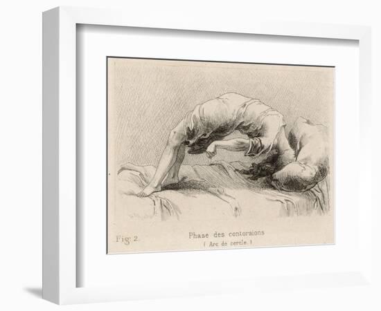 Mental Patient at la Salpetriere Going Through the Phase of Contortions-P. Richer-Framed Photographic Print