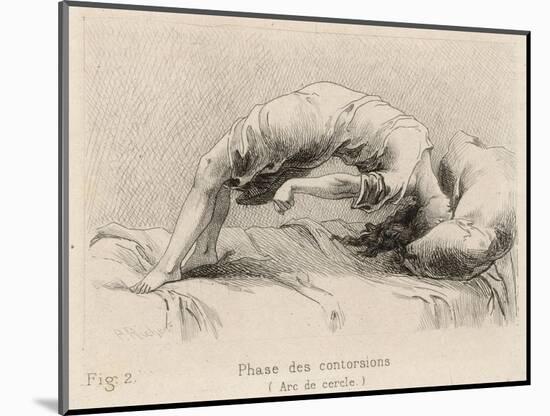 Mental Patient at la Salpetriere Going Through the Phase of Contortions-P. Richer-Mounted Photographic Print