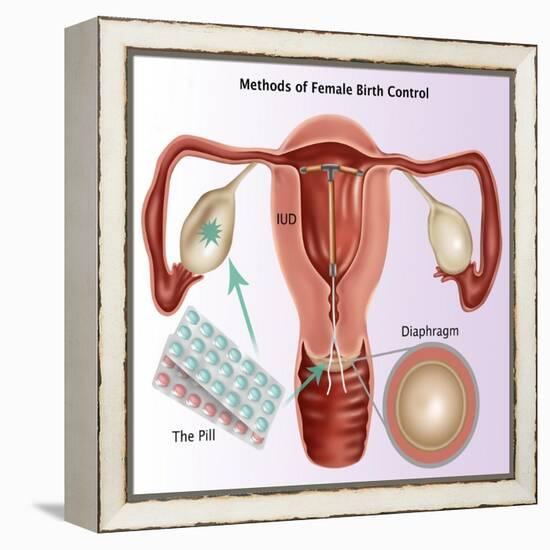 Methods of Female Birth Control-Gwen Shockey-Framed Premier Image Canvas