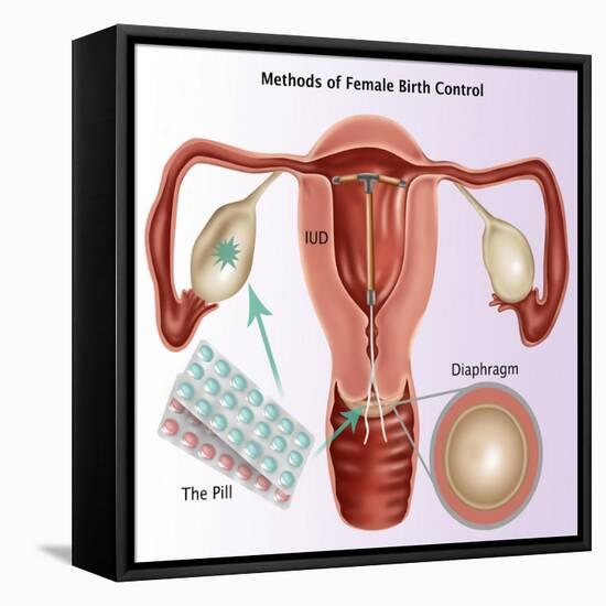 Methods of Female Birth Control-Gwen Shockey-Framed Premier Image Canvas